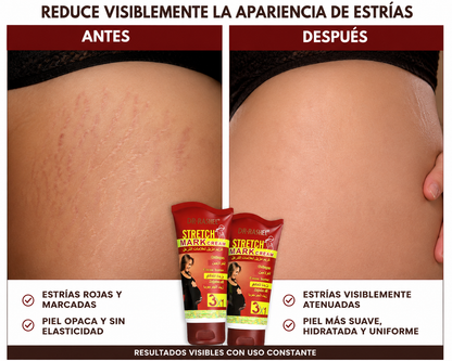 Crema Reductora de Estrías Dr. Rashel – Manteca de Cacao 150g | Pack 3x1